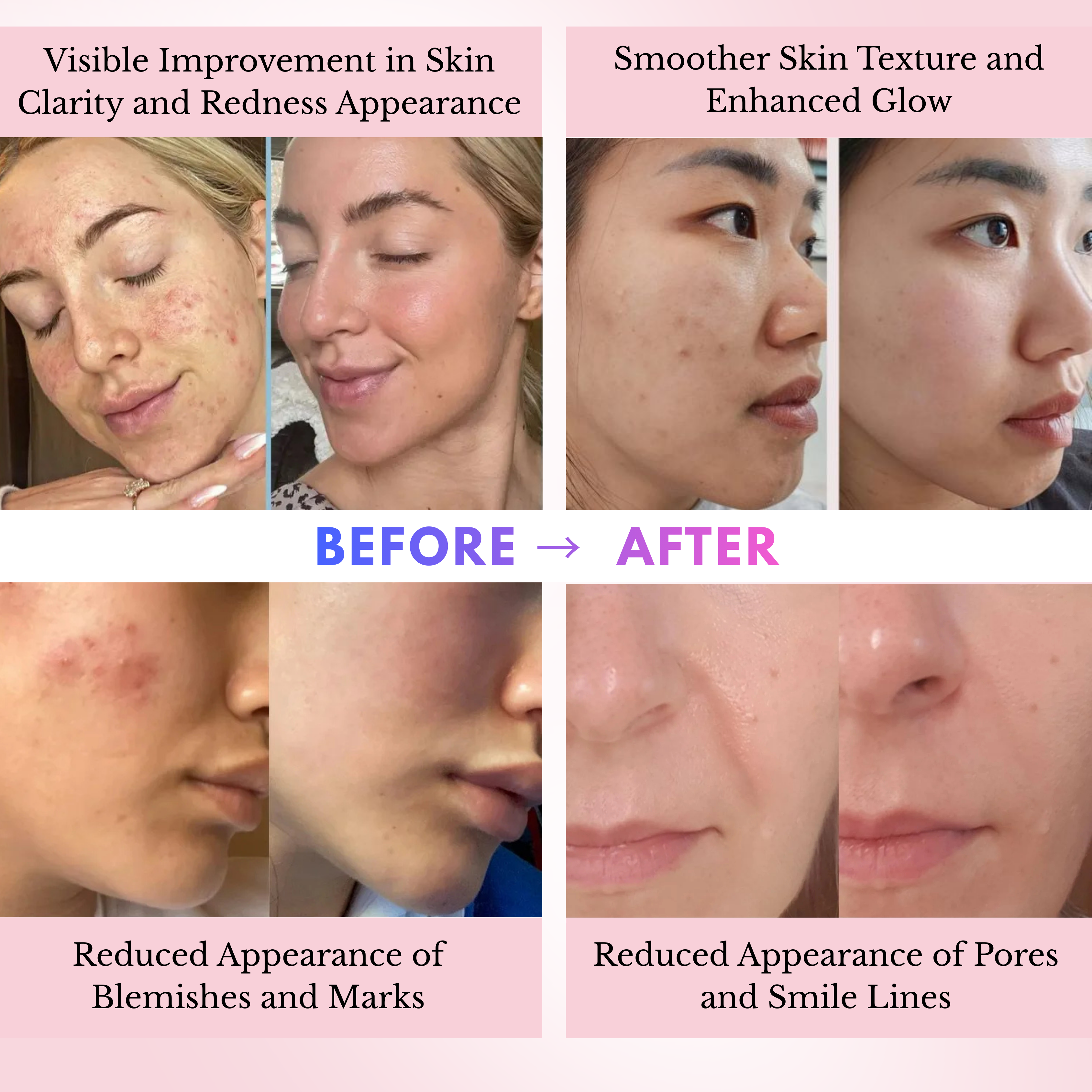 DERMORA SKIN BOOSTER PRO+